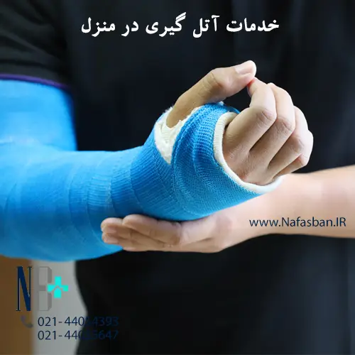 گچ گرفتن در منزل