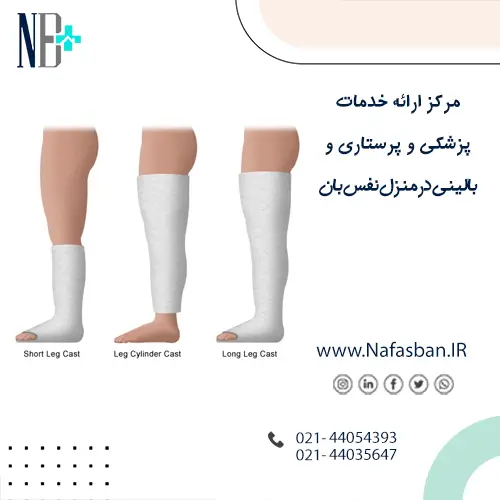 گچ گرفتن در منزل