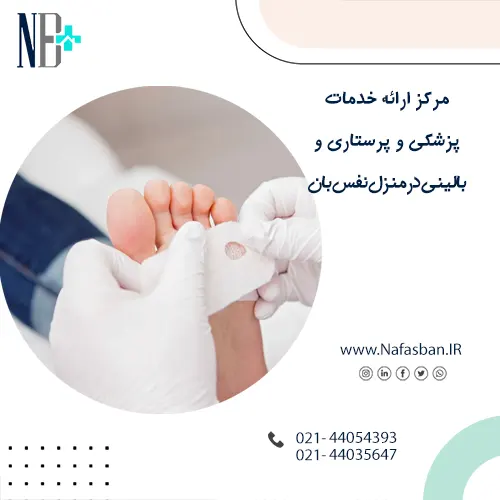 درمان پای دیابتی در منزل
