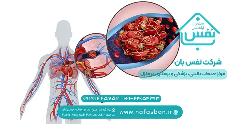 آمبولی ریه چیست و چگونه درمان میشود