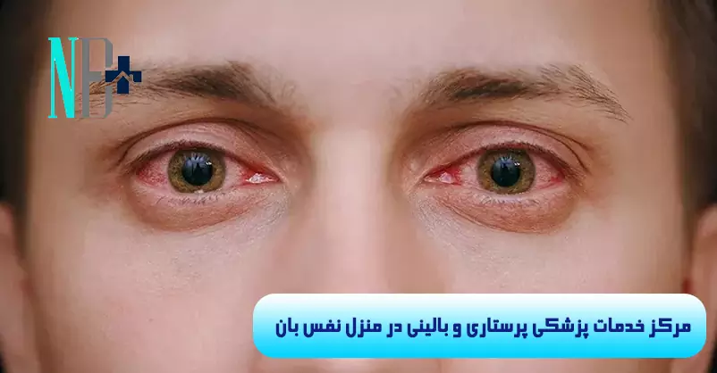 درمان عفونت چشم در منزل 6