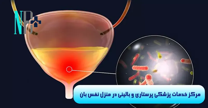 عفونت سوند ادراری چیست 2