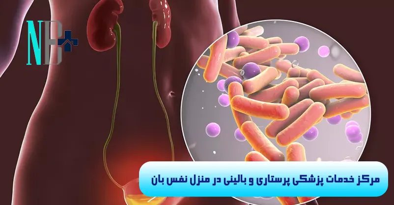 عفونت سوند ادراری چیست 3